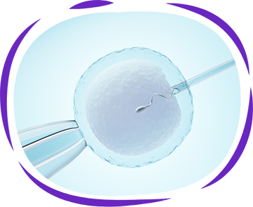 Intracytoplasmic Sperm Injection